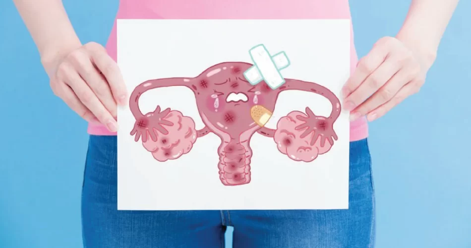 illustration of Unhealthy uterus